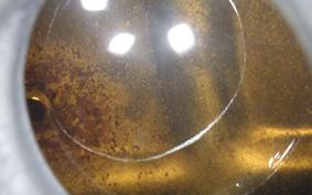 KAWASAKI BALIUS 250 ZR250A