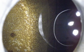 KAWASAKI VULCAN 1500 SIDECAR 1996 VNT50D